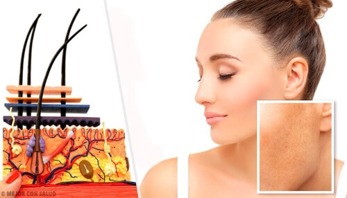 Przebarwienia na skórze – czym są, co je powoduje?