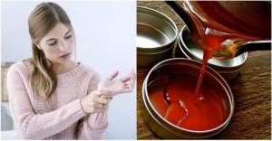 Ból stawów: przeciwzapalna maść na bazie pieprzu cayenne