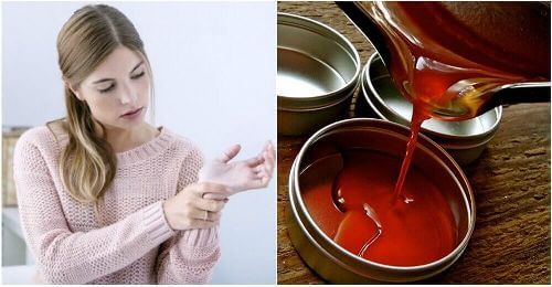Ból stawów: przeciwzapalna maść na bazie pieprzu cayenne