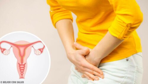 Bóle jajników – czy są objawem poważniejszego problemu?