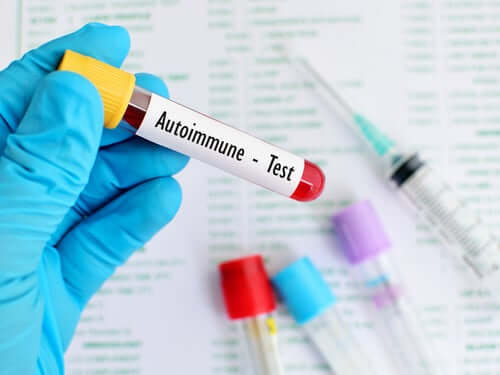 Testy ana choroby autoimmunizacyjne