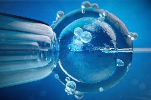Genetyczna diagnostyka preimplantacyjna