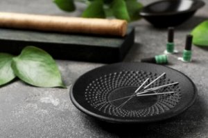 Akupunktura - 5 korzyści, o których warto wiedzieć