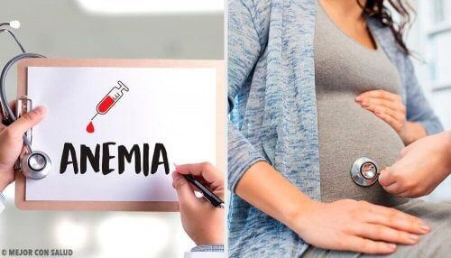Anemia