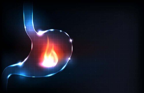 Refluks żołądka - palący ból