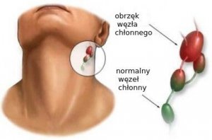 Węzeł wartowniczy: co musisz o nim wiedzieć?
