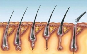 Pilomatrixoma mnogi - na czym polega ta choroba?