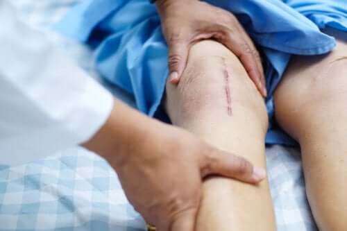 Chirurgia transplantacyjna kolana - rekonwalescencja
