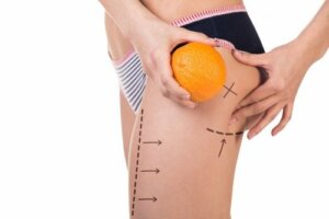 Dieta na cellulitis: poznaj 3 skuteczne menu