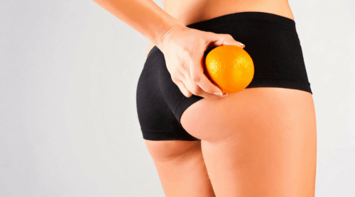Cellulit zwany skórką pomarańczową