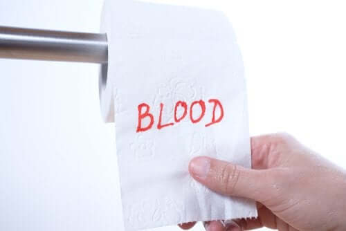 Krew w kale – czy wiesz, dlaczego tak się dzieje?