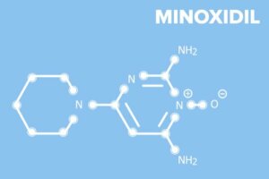 Minoksydyl - poznaj ten lek na łysienie i wypadanie włosów