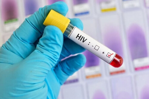 Wirus HIV
