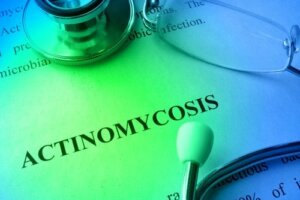 Aktynomikoza - czyli promienica, jej leczenie i zapobieganie