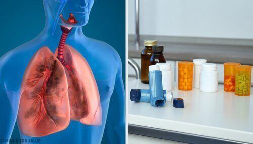 Leczenie płuc - terapia aerozolowa