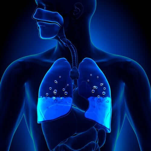 Obrzęk płuc: objawy i przyczyny powstawania