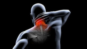 Przykurcz mięśni: zapobieganie i leczenie