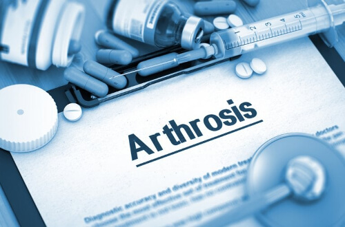 Leki na artretyzm