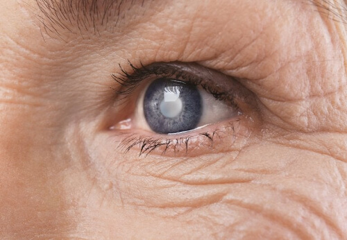 Hiperglikemia powoduje problemy ze wzrokiem