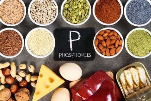 Hiperfosfatemia: zaburzenie równowagi fosforanowej w organizmie