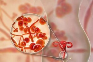 Mycoplasma genitalium: przyczyny, objawy i leczenie