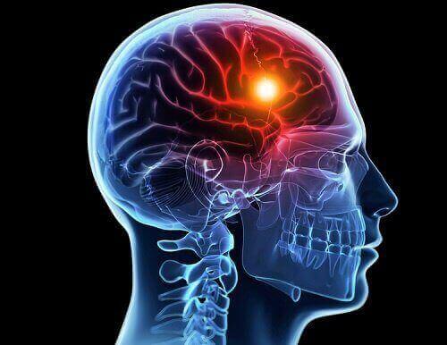 Podświetlony mózg