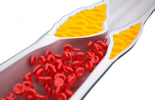 Cholesterol we krwi grafika
