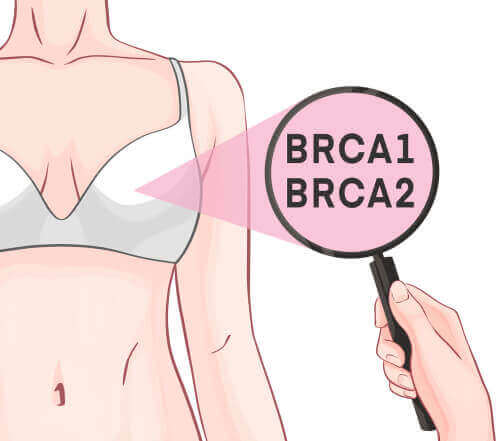 Geny BRCA-1 i BRCA-2 oraz rak piersi