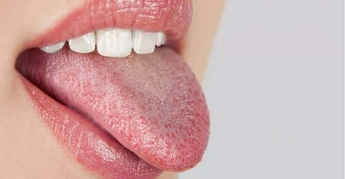 Kobieta wystawiająca język - pieczenie w ustach