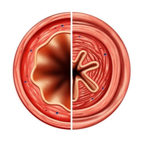 Terbutalina i oskrzela