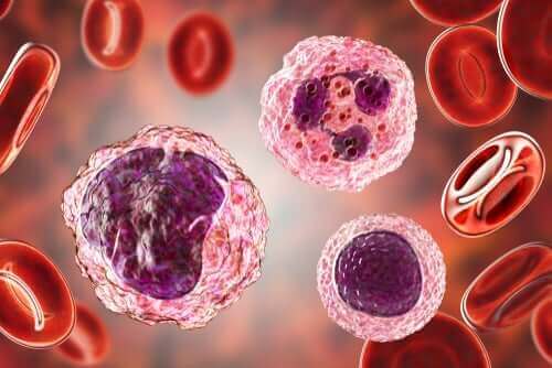 Wysoki poziom monocytów we krwi: objawy i leczenie