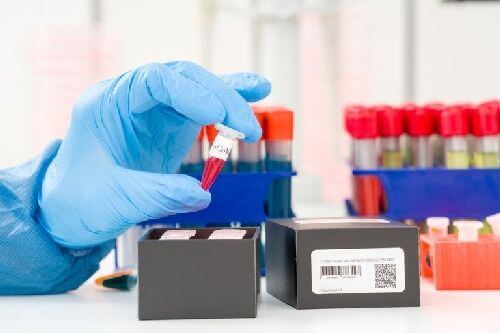Wykrywanie koronawirusa: czym jest test PCR?