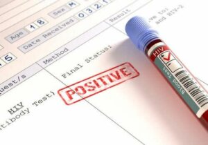 Czy osoby zarażone HIV są bardziej zagrożone przez koronawirusa?