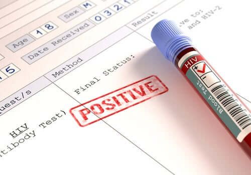 Czy osoby zarażone HIV są bardziej zagrożone przez koronawirusa?