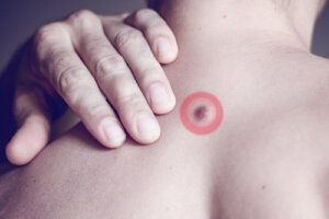 Grudki tłuszczu na plecach: z czego wynikają?