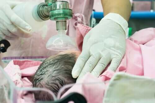 Lekarz podający tlen noworodkowi - choroby układu oddechowego u noworodków