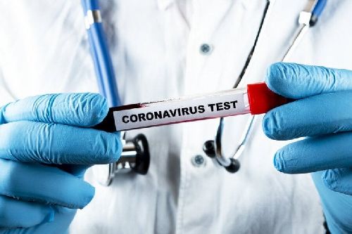 Testy na koronawirusa