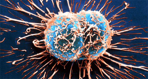 Jak układ odpornościowy walczy z rakiem?