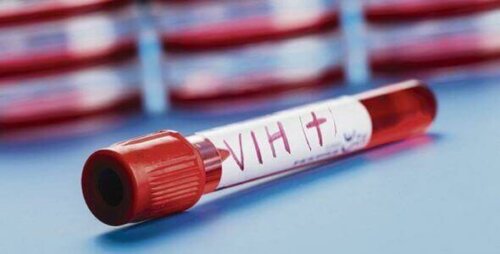 Fiolka krwi z wirusem HIV