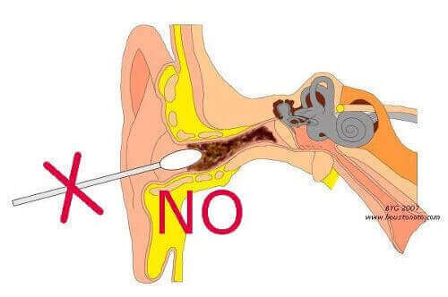Patyczek w uchu