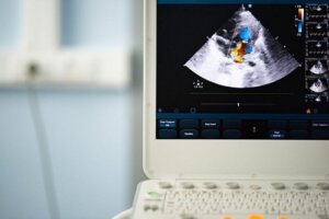 Dwupłatkowa zastawka aorty: diagnoza i leczenie