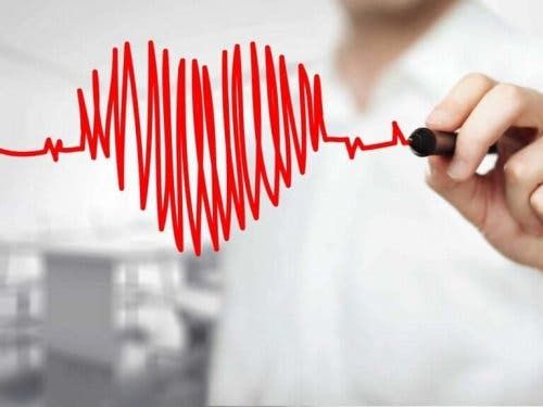 EKG