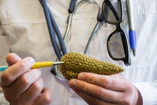 Model trzustki a hiperinsulinemia