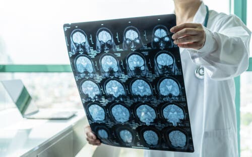 Neurologia i obraz mózgu