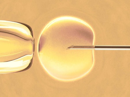 Zapłodnienie in vitro: czy wiesz na czym polega?