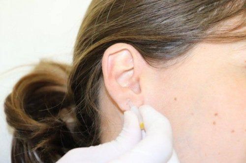Akupunktura ucha jako metoda leczenia choroby Parkinsona