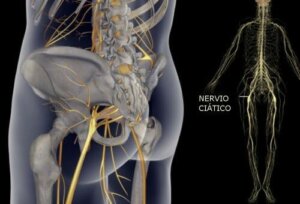 Proste ćwiczenia fizyczne na złagodzenie bólu nerwu kulszowego