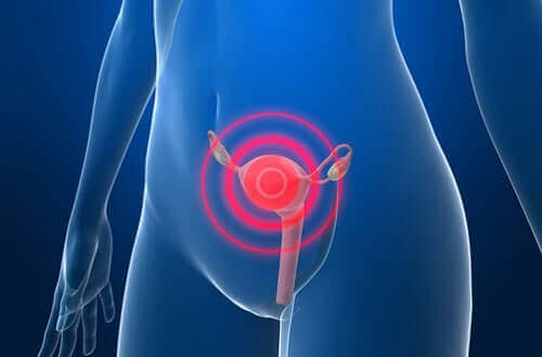 Rak endometrium – leczenie po jego rozpoznaniu