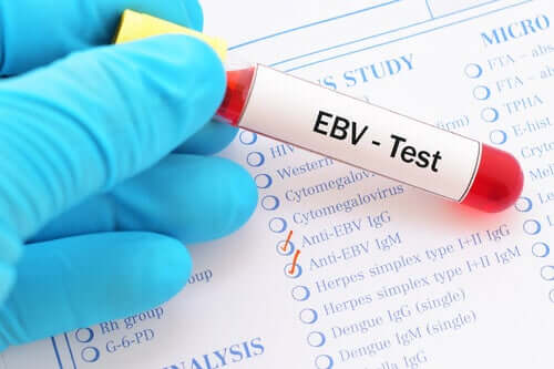 Powodujący mononukleozę wirus Epsteina-Barra oznacza się sygnaturą EBV.