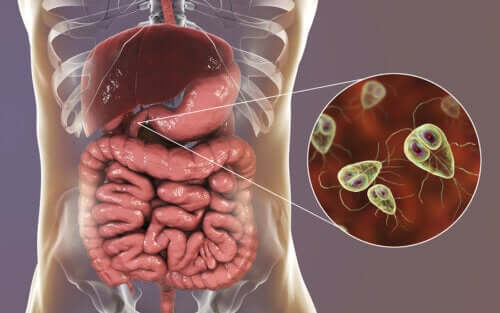 Giardia - paraziti intestinali, Dieta giardia pentru oameni